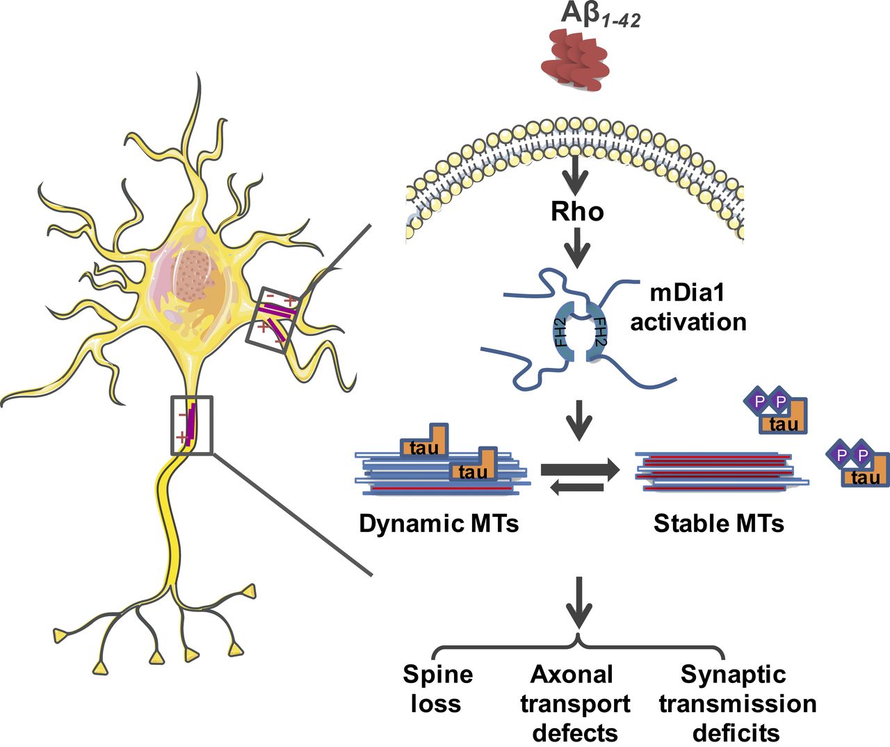 Microtubule regulating pathways in neurodegeneration and CIPN